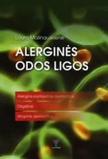 Alerginės odos ligos — medicina