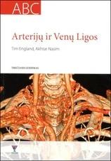 Arterijų ir venų ligos