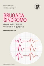 Brugada sindromo diagnostika, rizikos vertinimas ir gydymas