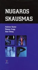Nugaros skausmas