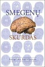 Smegenų skurdas